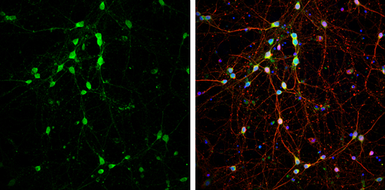 Anti-DARPP-32 antibody used in Immunocytochemistry/ Immunofluorescence (ICC/IF). GTX133350