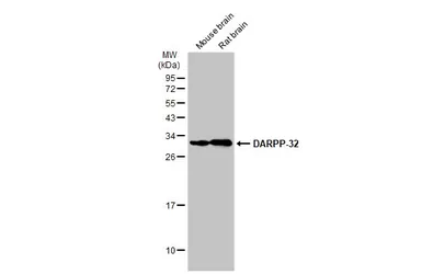 Anti-DARPP-32 antibody used in Western Blot (WB). GTX133350