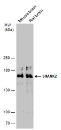 Anti-SHANK2 antibody used in Western Blot (WB). GTX133352