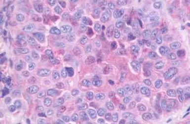 Anti-GRPR antibody used in IHC (Paraffin sections) (IHC-P). GTX13339