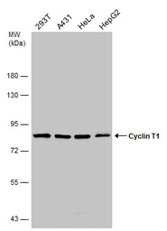 Anti-Cyclin T1 antibody used in Western Blot (WB). GTX133413