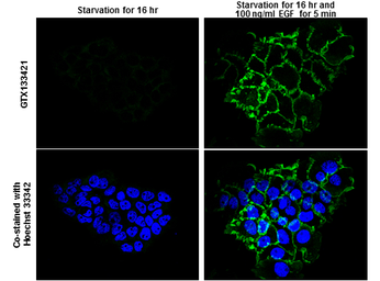 Anti-EGFR (phospho Tyr1086) antibody used in Immunocytochemistry/ Immunofluorescence (ICC/IF). GTX133421