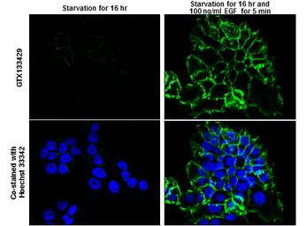 Anti-EGFR (phospho Tyr992) antibody used in Immunocytochemistry/ Immunofluorescence (ICC/IF). GTX133429