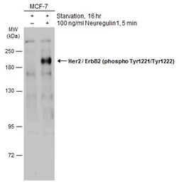Anti-Her2 / ErbB2 (phospho Tyr1221/Tyr1222) antibody used in Western Blot (WB). GTX133445