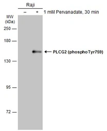 Anti-PLCG2 (phospho Tyr759) antibody used in Western Blot (WB). GTX133463