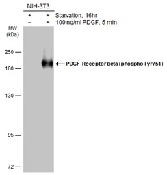 Anti-PDGF Receptor beta (phospho Tyr751) antibody used in Western Blot (WB). GTX133525