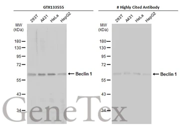Anti-Beclin 1 antibody used in Western Blot (WB). GTX133555