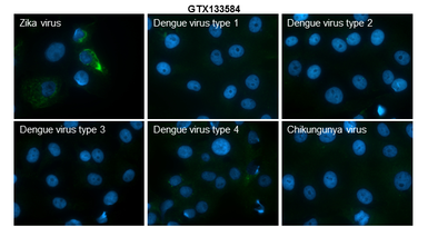 Anti-Zika virus prM protein antibody used in Immunocytochemistry/ Immunofluorescence (ICC/IF). GTX133584
