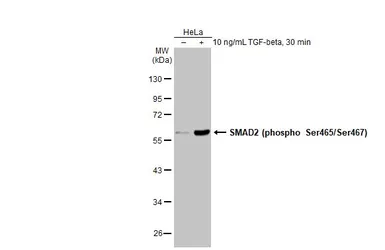 Anti-SMAD2 (phospho Ser465/Ser467) antibody used in Western Blot (WB). GTX133614