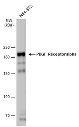 Anti-PDGF Receptor alpha antibody used in Western Blot (WB). GTX133620