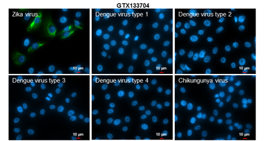 Anti-Zika virus NS4A protein antibody used in Immunocytochemistry/ Immunofluorescence (ICC/IF). GTX133704
