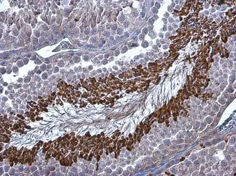 Anti-Brachyury antibody used in IHC (Paraffin sections) (IHC-P). GTX133714