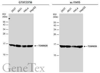 Anti-TOMM20 antibody used in Western Blot (WB). GTX133756