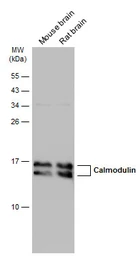 Anti-Calmodulin antibody used in Western Blot (WB). GTX133805
