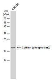 Anti-Cofilin 1 (phospho Ser3) antibody used in Western Blot (WB). GTX133865
