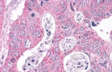 Anti-NEK6 antibody used in IHC (Paraffin sections) (IHC-P). GTX13387