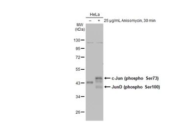 Anti-c-Jun (phospho Ser73) antibody used in Western Blot (WB). GTX133873
