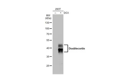 Anti-Doublecortin antibody used in Western Blot (WB). GTX134052