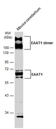 Anti-EAAT1 antibody used in Western Blot (WB). GTX134059