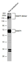 Anti-EAAT1 antibody used in Western Blot (WB). GTX134059
