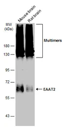 Anti-EAAT2 antibody used in Western Blot (WB). GTX134062
