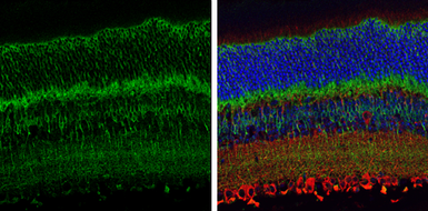 Anti-EAAT2 antibody used in IHC (Paraffin sections) (IHC-P). GTX134062