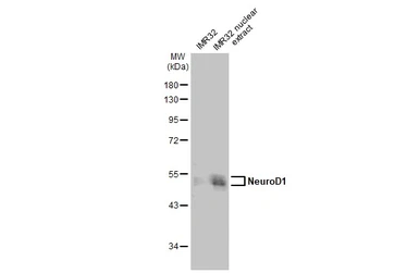 Anti-NeuroD1 antibody used in Western Blot (WB). GTX134069