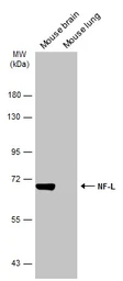 Anti-NF-L antibody used in Western Blot (WB). GTX134075