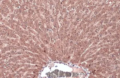 Anti-FGFR4 antibody used in IHC (Paraffin sections) (IHC-P). GTX134355