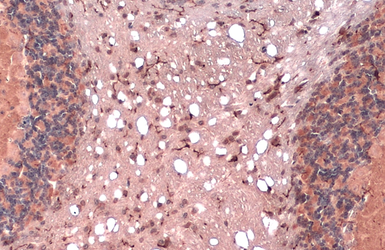 Anti-CD11b antibody used in IHC (Paraffin sections) (IHC-P). GTX134493