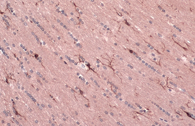 Anti-CD11b antibody used in IHC (Paraffin sections) (IHC-P). GTX134493