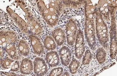 Anti-Caspase 1 p10 subunit antibody used in IHC (Paraffin sections) (IHC-P). GTX134551