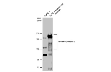 Anti-Thrombospondin 2 antibody used in Western Blot (WB). GTX134554