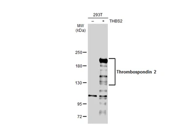 Anti-Thrombospondin 2 antibody used in Western Blot (WB). GTX134554