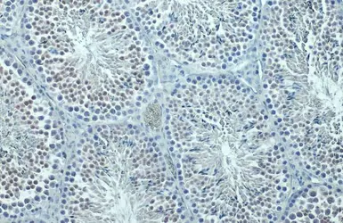 Anti-SIRT1 antibody used in IHC (Paraffin sections) (IHC-P). GTX134606
