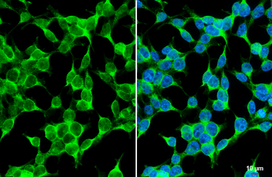 Anti-TAK1 antibody used in Immunocytochemistry/ Immunofluorescence (ICC/IF). GTX134664
