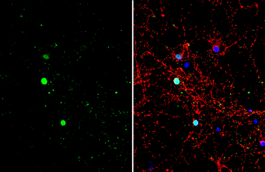 Anti-CTIP2 antibody used in Immunocytochemistry/ Immunofluorescence (ICC/IF). GTX134767