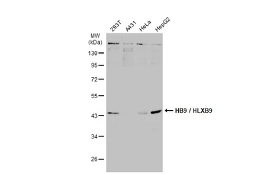Anti-HB9 / HLXB9 antibody used in Western Blot (WB). GTX134781