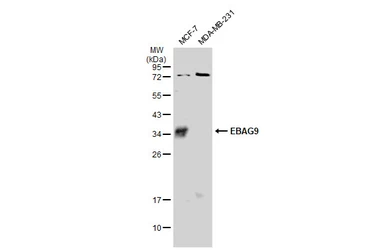 Anti-EBAG9 antibody used in Western Blot (WB). GTX134856