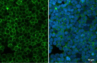 Anti-Myeloperoxidase antibody used in Immunocytochemistry/ Immunofluorescence (ICC/IF). GTX135125