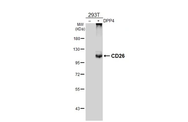 Anti-CD26 antibody used in Western Blot (WB). GTX135137