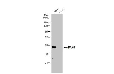 Anti-PAX8 antibody used in Western Blot (WB). GTX135144