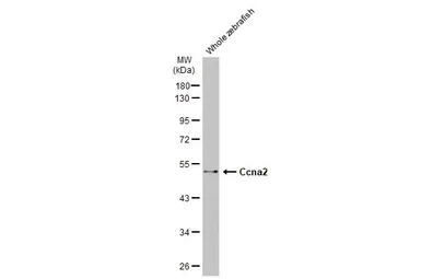 Anti-Ccna2 antibody used in Western Blot (WB). GTX135147