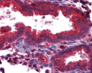 Anti-TAP1 antibody used in Immunohistochemistry (IHC). GTX13516