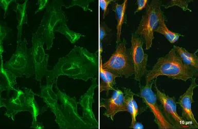 Anti-CD63 antibody used in Immunocytochemistry/ Immunofluorescence (ICC/IF). GTX135220