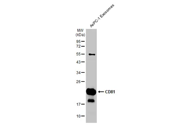 Anti-CD81 antibody used in Western Blot (WB). GTX135297