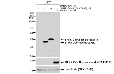 Anti-SARS-CoV-2 (COVID-19) Nucleocapsid antibody used in Western Blot (WB). GTX135357