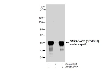 Anti-SARS-CoV-2 (COVID-19) Nucleocapsid antibody used in Immunoprecipitation (IP). GTX135357