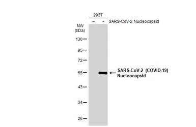 Anti-SARS-CoV-2 (COVID-19) Nucleocapsid antibody used in Western Blot (WB). GTX135357