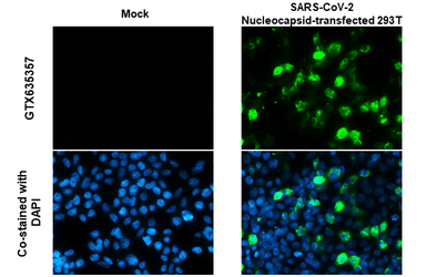Anti-SARS-CoV-2 (COVID-19) Nucleocapsid antibody used in Immunocytochemistry/ Immunofluorescence (ICC/IF). GTX135357